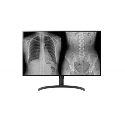 Monitor 32 lg 32hl512d-b.aeu 8mp diagnostic color designed for radiology